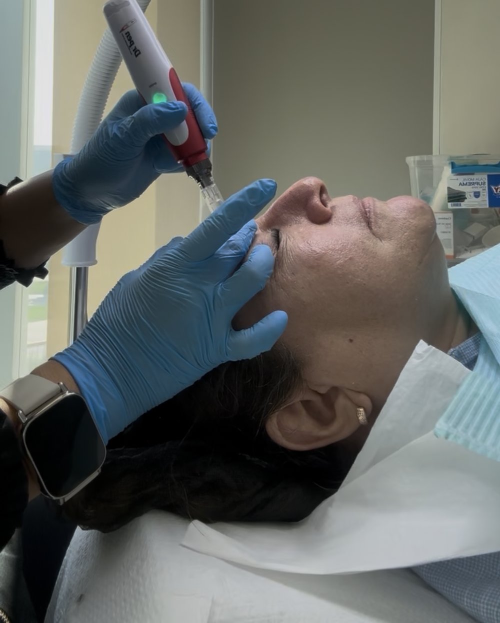 Microneedling con Dr. Pen · Paloma Guajardo